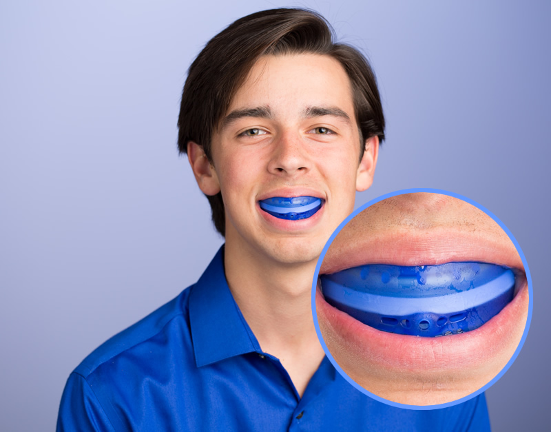 Teenage boy with a mouthguard, and a larger inset, closer up image of the mouthguard to see the proper way to wear them. 