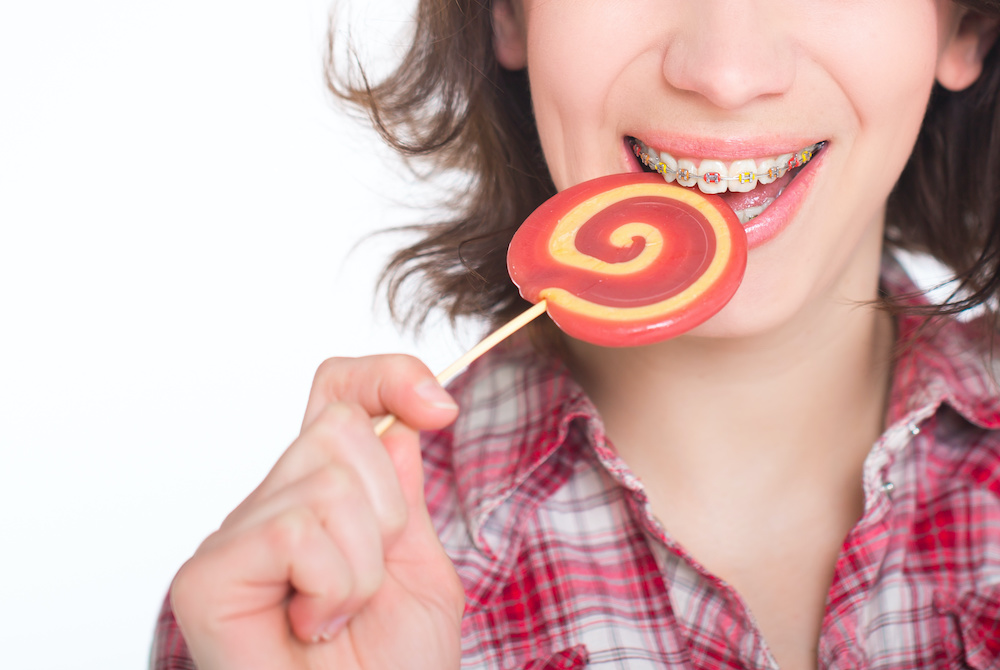 Guide To Eating With Braces American Association Of Orthodontists 