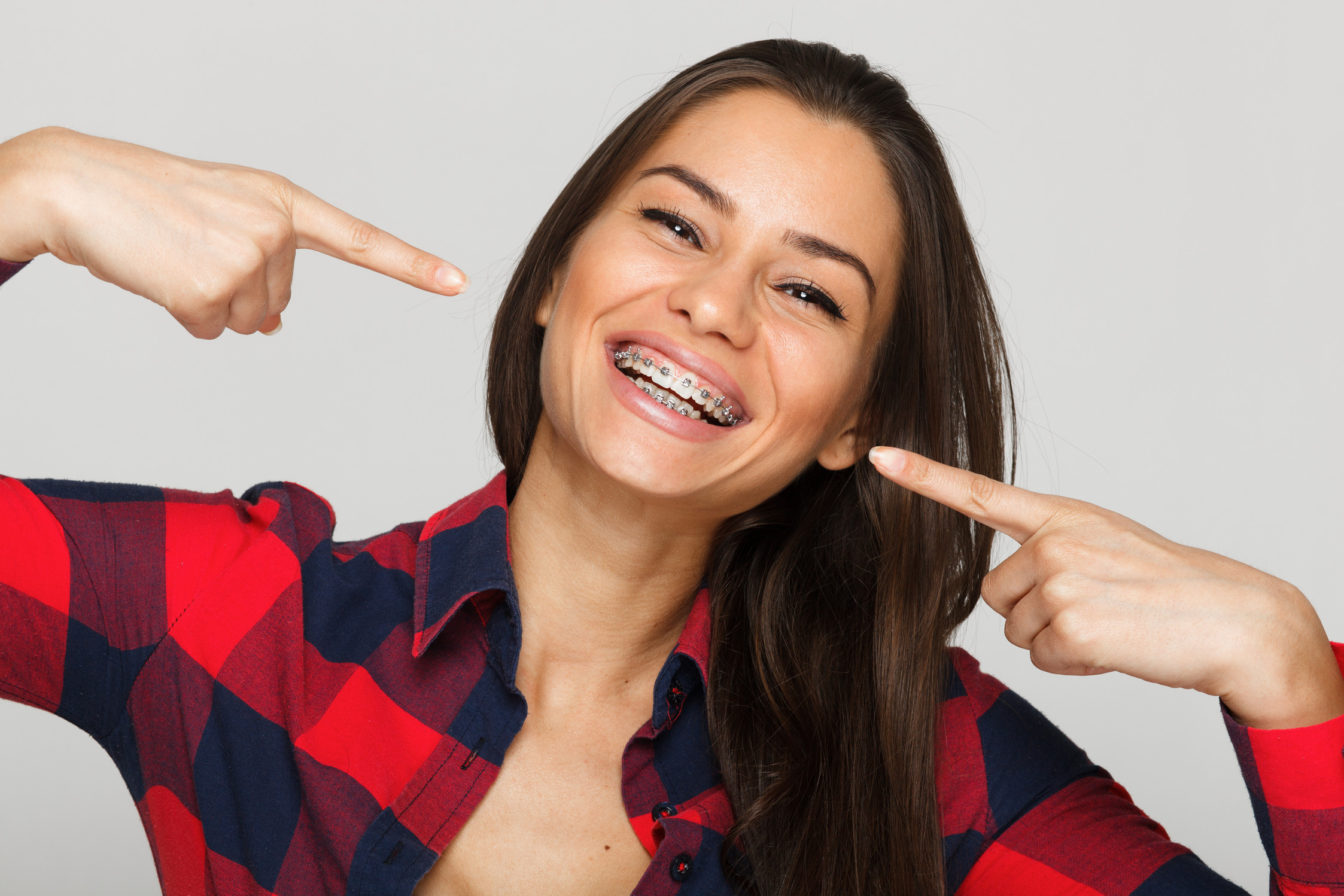 Adult woman smiling, pointing to and showing off her traditional braces.