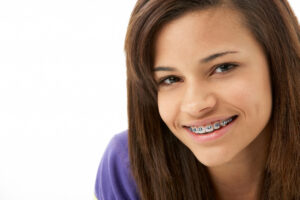 Do Braces Hurt? Managing Orthodontic Discomfort American Association